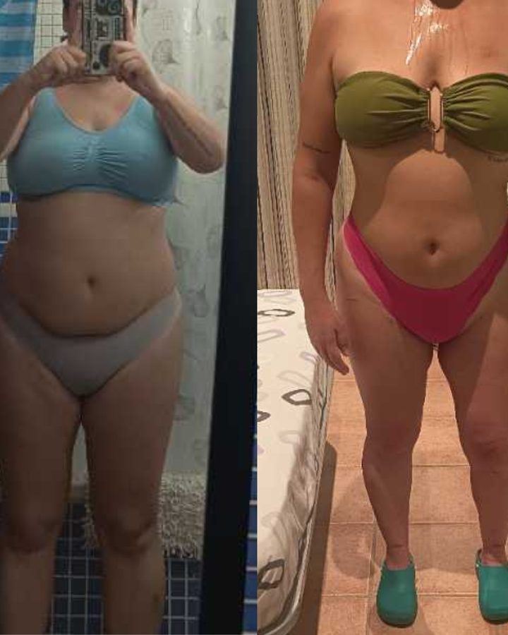 Antes y después de Ana