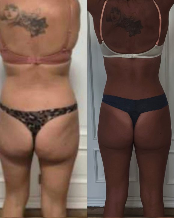 Antes y después de Lola