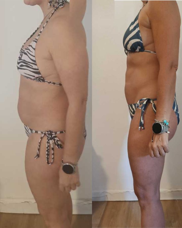 Antes y después de Vanessa